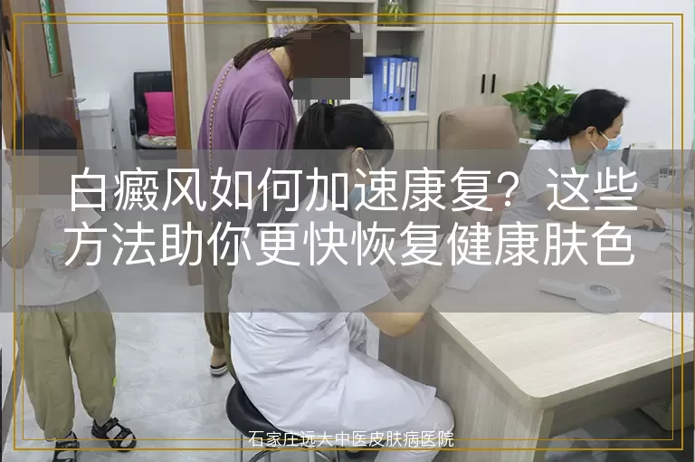 白癜风如何加速康复？这些方法助你更快恢复健康肤色