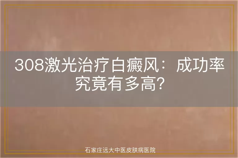 308激光治疗白癜风：成功率究竟有多高？