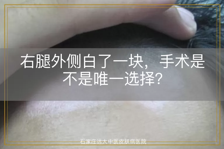 右腿外侧白了一块，手术是不是唯一选择？
