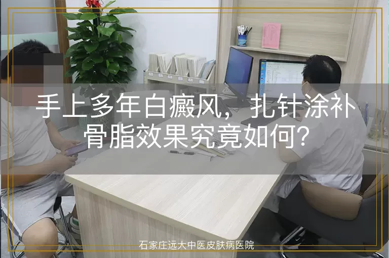 手上多年白癜风，扎针涂补骨脂效果究竟如何？