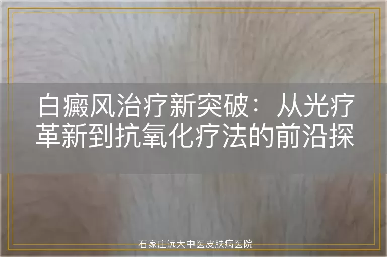 白癜风治疗新突破：从光疗革新到抗氧化疗法的前沿探索