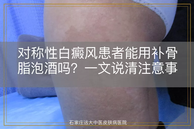 对称性白癜风患者能用补骨脂泡酒吗？一文说清注意事项