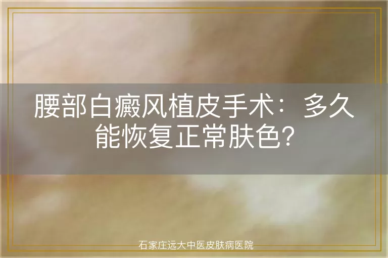 腰部白癜风植皮手术：多久能恢复正常肤色？
