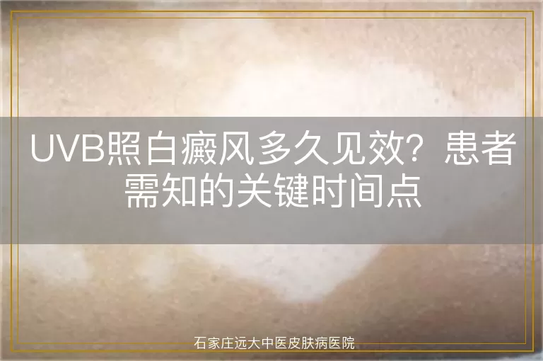 UVB照白癜风多久见效？患者需知的关键时间点
