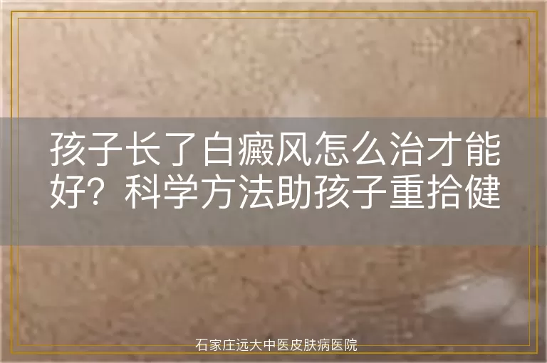 孩子长了白癜风怎么治才能好？科学方法助孩子重拾健康