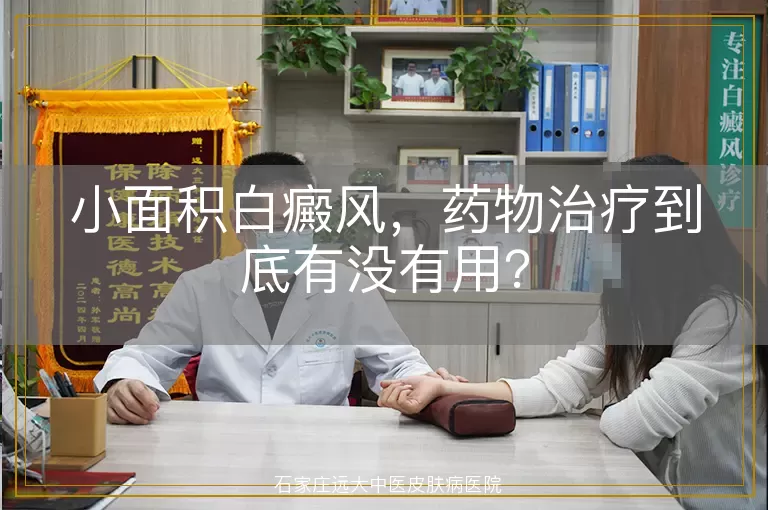 小面积白癜风，药物治疗到底有没有用？