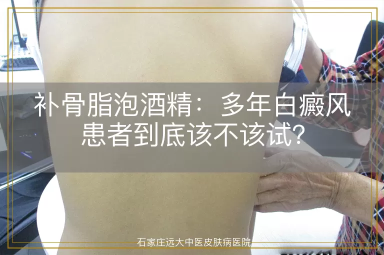 补骨脂泡酒精：多年白癜风患者到底该不该试？