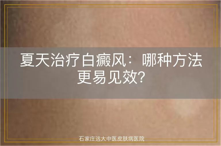 夏天治疗白癜风：哪种方法更易见效？