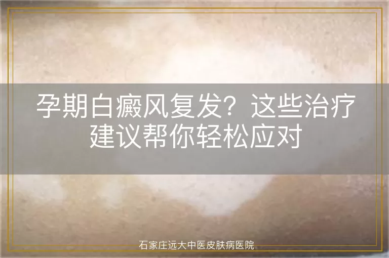 孕期白癜风复发？这些治疗建议帮你轻松应对