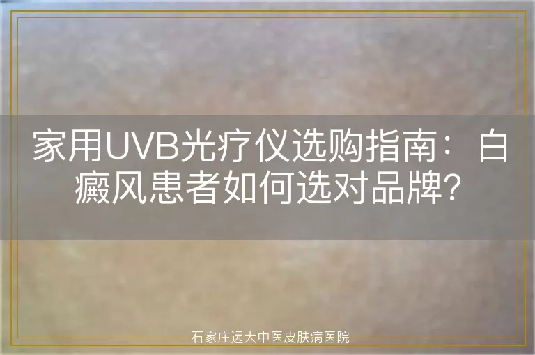 家用UVB光疗仪选购指南：白癜风患者如何选对品牌？