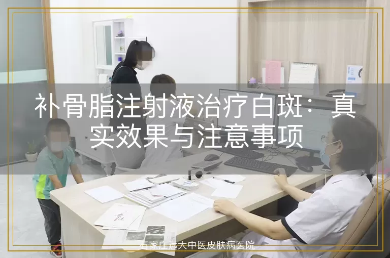 补骨脂注射液治疗白斑：真实效果与注意事项