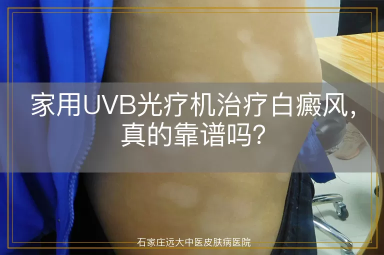 家用UVB光疗机治疗白癜风，真的靠谱吗？