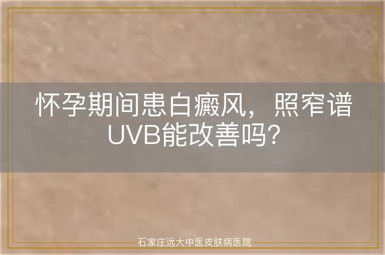 怀孕期间患白癜风，照窄谱UVB能改善吗？