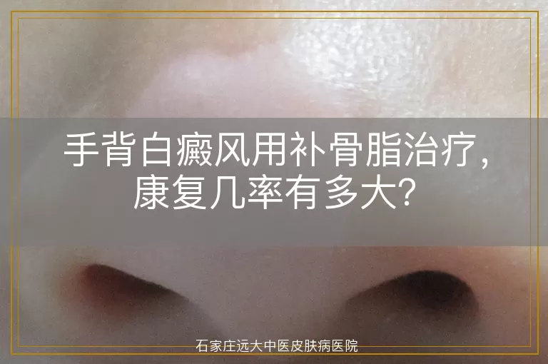 手背白癜风用补骨脂治疗，康复几率有多大？