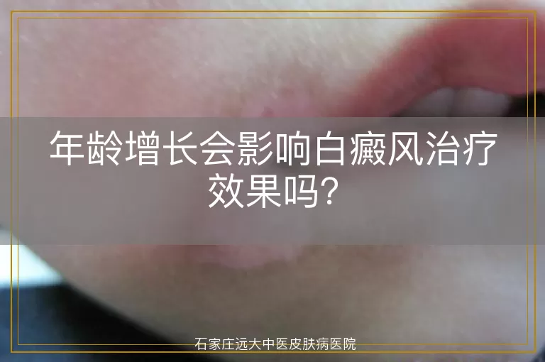 年龄增长会影响白癜风治疗效果吗？