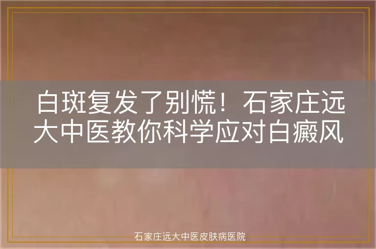 白斑复发了别慌！石家庄远大中医教你科学应对白癜风复发