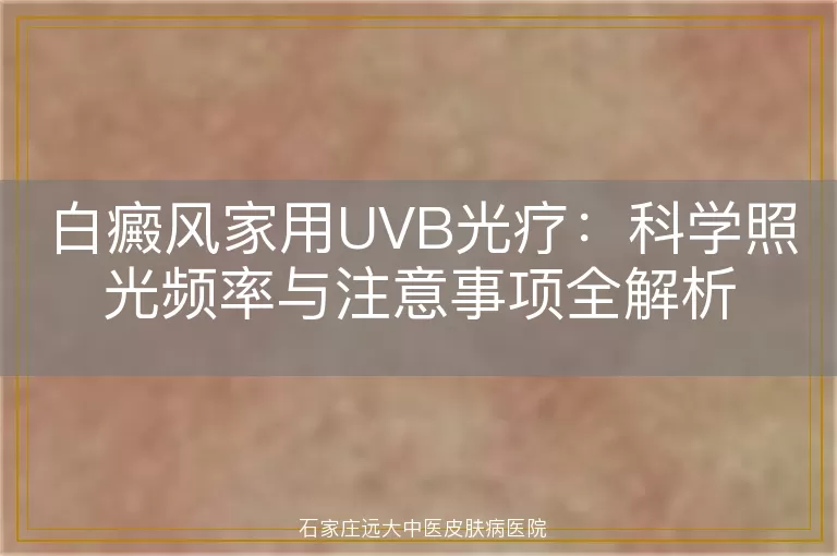 白癜风家用UVB光疗：科学照光频率与注意事项全解析