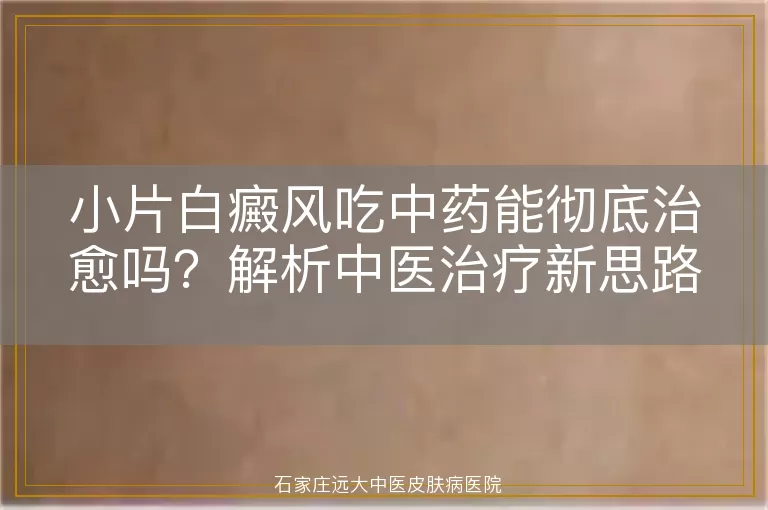 小片白癜风吃中药能彻底治愈吗？解析中医治疗新思路