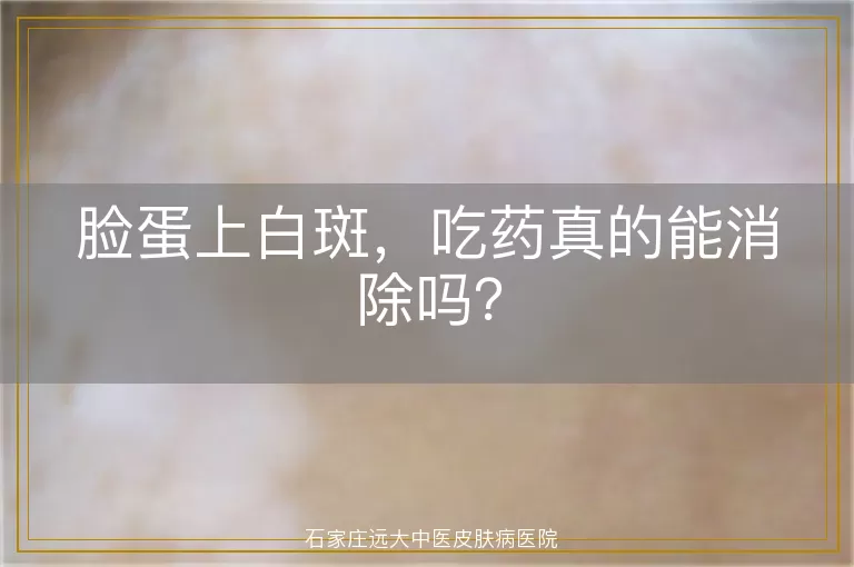 脸蛋上白斑，吃药真的能消除吗？