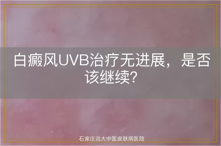 白癜风UVB治疗无进展，是否该继续？