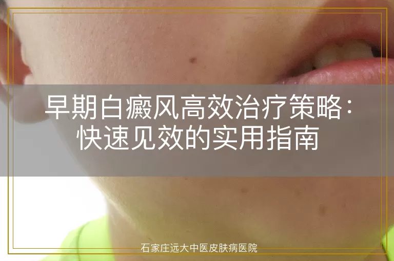早期白癜风高效治疗策略：快速见效的实用指南
