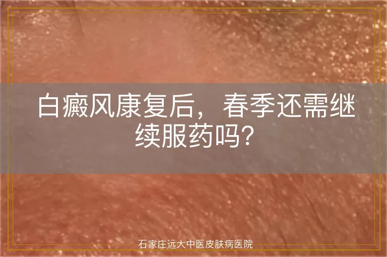 白癜风康复后，春季还需继续服药吗？