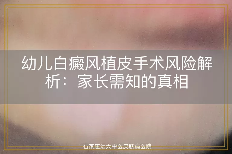 幼儿白癜风植皮手术风险解析：家长需知的真相