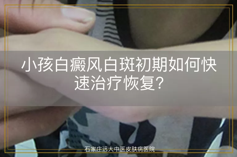 小孩白癜风白斑初期如何快速治疗恢复？