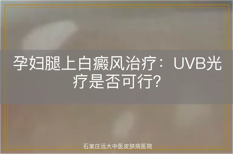孕妇腿上白癜风治疗：UVB光疗是否可行？