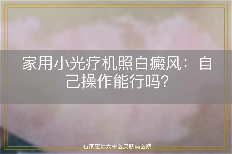 家用小光疗机照白癜风：自己操作能行吗？