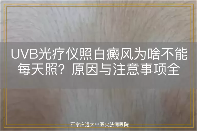 UVB光疗仪照白癜风为啥不能每天照？原因与注意事项全解析