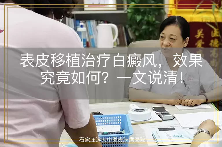 表皮移植治疗白癜风，效果究竟如何？一文说清！