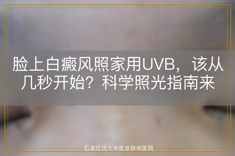 脸上白癜风照家用UVB，该从几秒开始？科学照光指南来了