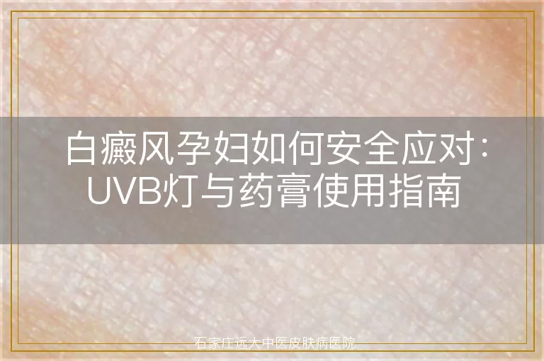 白癜风孕妇如何安全应对：UVB灯与药膏使用指南