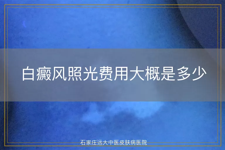 白癜风照光费用大概是多少