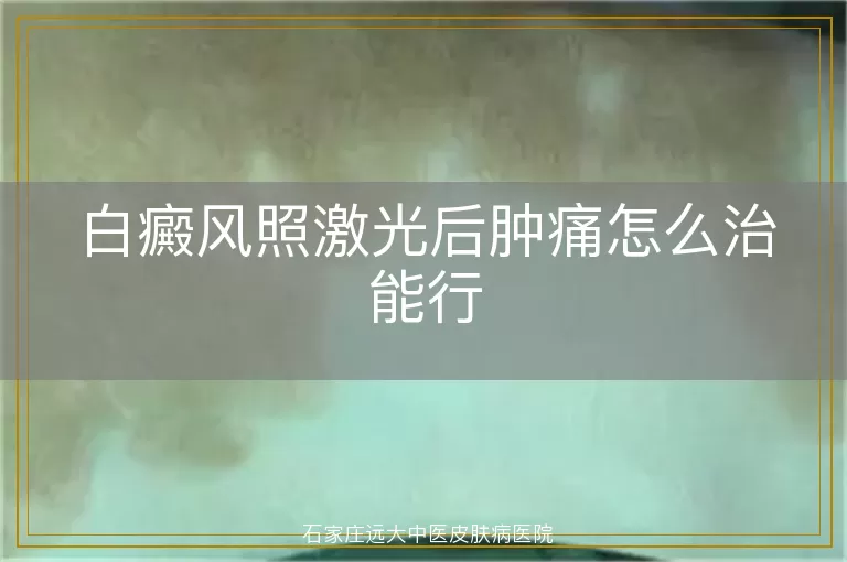 白癜风照激光后肿痛怎么治能行