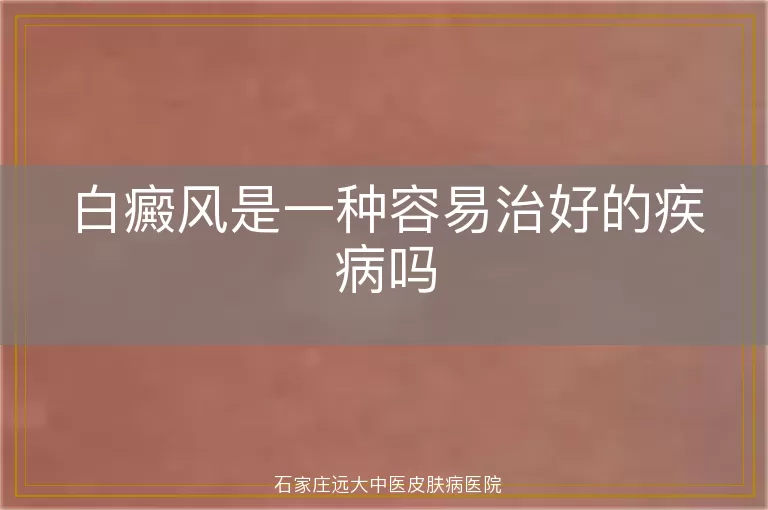 白癜风是一种容易治好的疾病吗