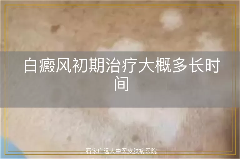 白癜风初期治疗大概多长时间