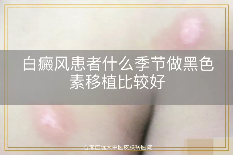 白癜风患者什么季节做黑色素移植比较好
