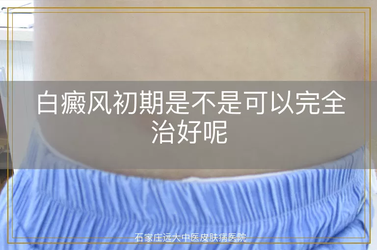 白癜风初期是不是可以完全治好呢