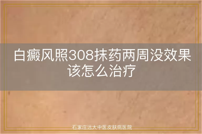 白癜风照308抹药两周没效果该怎么治疗
