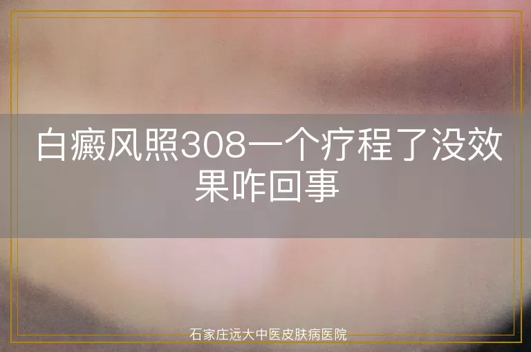白癜风照308一个疗程了没效果咋回事