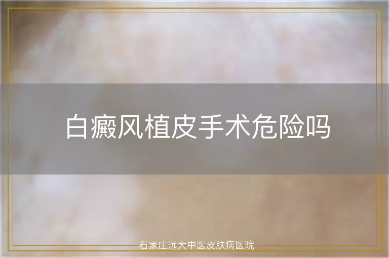 白癜风植皮手术危险吗