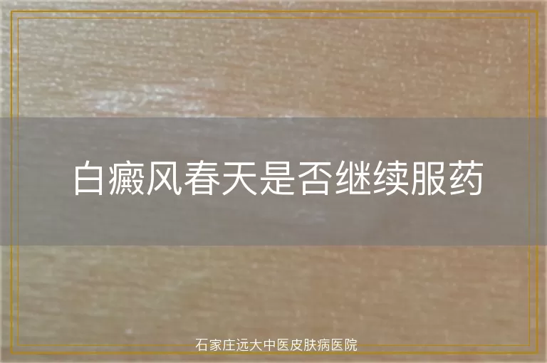 白癜风春天是否继续服药