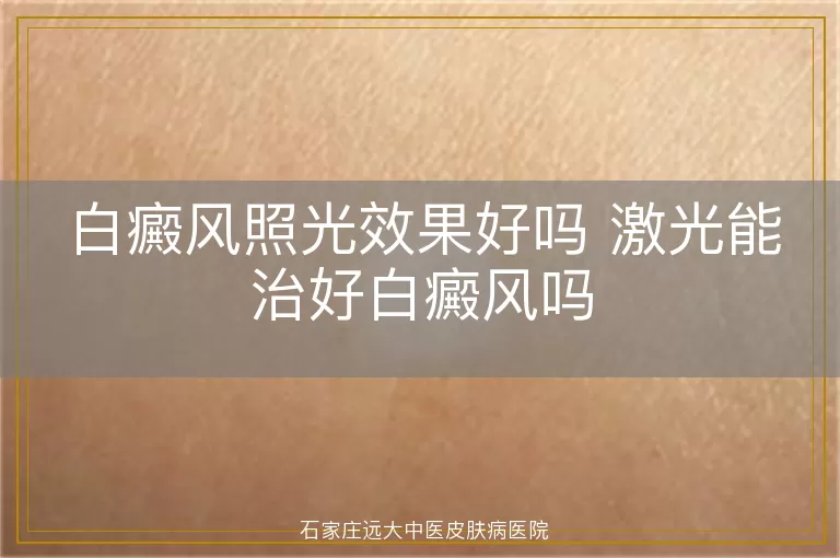 白癜风照光效果好吗 激光能治好白癜风吗