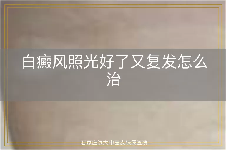 白癜风照光好了又复发怎么治