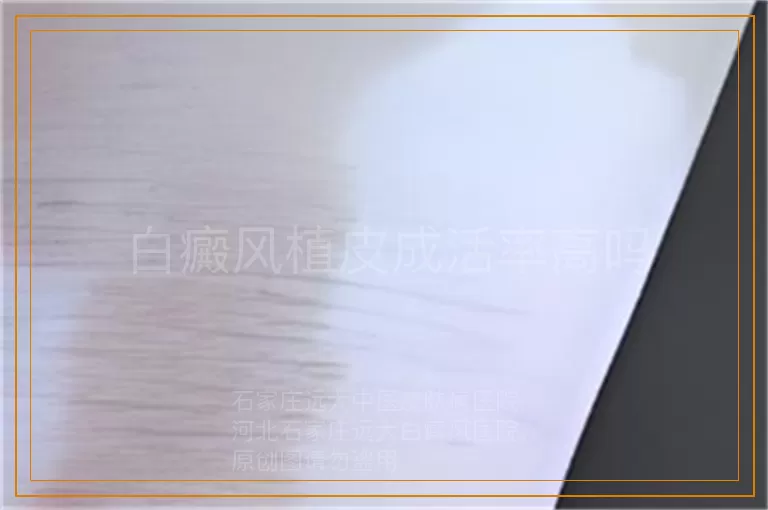 白癜风植皮成活率高吗