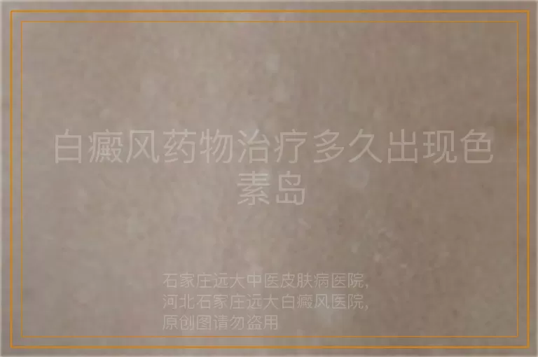 白癜风药物治疗多久出现色素岛
