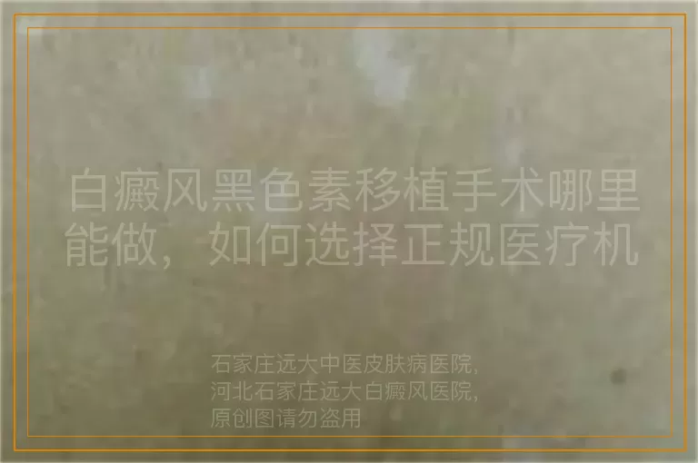 白癜风黑色素移植手术哪里能做，如何选择正规医疗机构