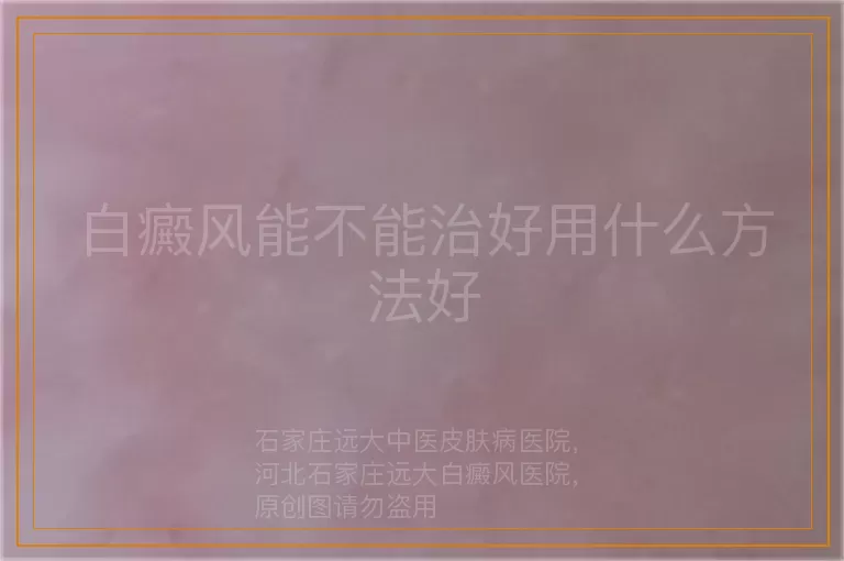 白癜风能不能治好用什么方法好